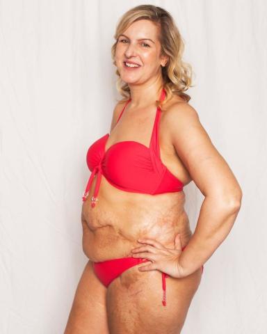 Η καμπάνια – γροθιά στο στομάχι που θα σε κάνει να αγαπήσεις το κορμί σου ακριβώς όπως είναι Η καμπάνια – γροθιά στο στομάχι που θα σε κάνει να αγαπήσεις το κορμί σου ακριβώς όπως είναι