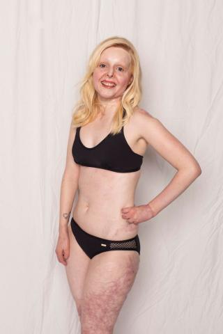 Η καμπάνια – γροθιά στο στομάχι που θα σε κάνει να αγαπήσεις το κορμί σου ακριβώς όπως είναι Η καμπάνια – γροθιά στο στομάχι που θα σε κάνει να αγαπήσεις το κορμί σου ακριβώς όπως είναι