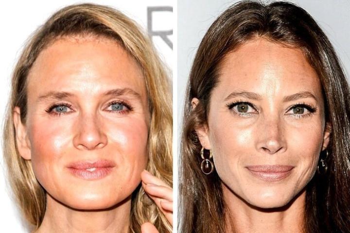 Οι πλαστικές έκαναν (ξανά) το θαύμα τους: Κι όμως, αυτές οι celebrities έχουν την ίδια ηλικία Οι πλαστικές έκαναν (ξανά) το θαύμα τους: Κι όμως, αυτές οι celebrities έχουν την ίδια ηλικία