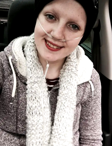 Η γυναίκα που είναι αλλεργική στα πάντα έχει κάτι πολύ σημαντικό να μας μάθει για τη ζωή Η γυναίκα που είναι αλλεργική στα πάντα έχει κάτι πολύ σημαντικό να μας μάθει για τη ζωή