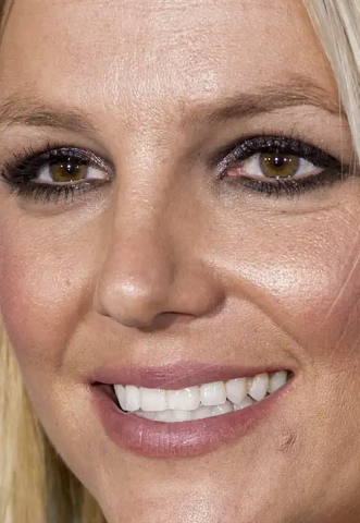 10 + 1 celebrities στα close-ups που αποδεικνύουν πως κανείς δεν είναι τέλειος 10 + 1 celebrities στα close-ups που αποδεικνύουν πως κανείς δεν είναι τέλειος