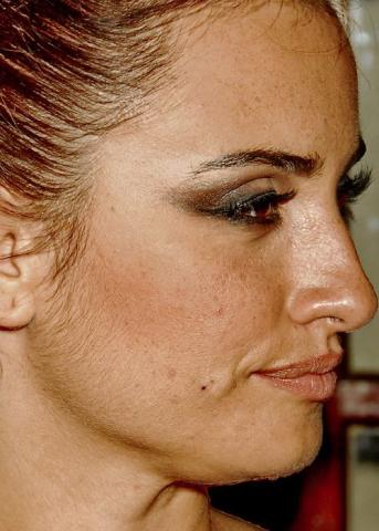 10 + 1 celebrities στα close-ups που αποδεικνύουν πως κανείς δεν είναι τέλειος 10 + 1 celebrities στα close-ups που αποδεικνύουν πως κανείς δεν είναι τέλειος