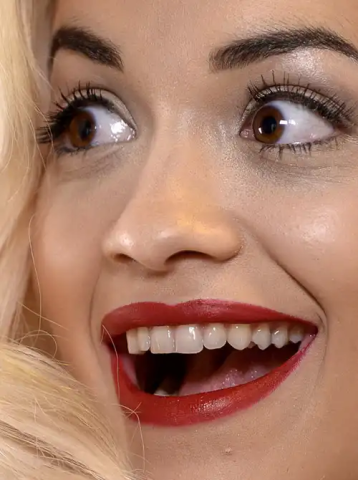 10 + 1 celebrities στα close-ups που αποδεικνύουν πως κανείς δεν είναι τέλειος 10 + 1 celebrities στα close-ups που αποδεικνύουν πως κανείς δεν είναι τέλειος