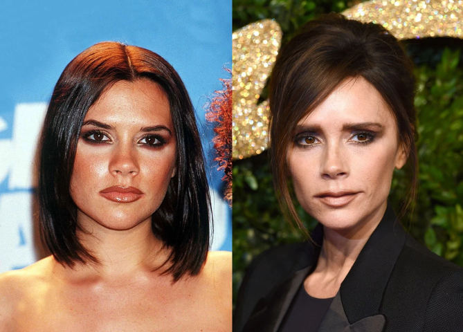 Victoria Beckham: Πόσο την άλλαξαν οι πλαστικές επεμβάσεις όλα αυτά τα χρόνια; Victoria Beckham: Πόσο την άλλαξαν οι πλαστικές επεμβάσεις όλα αυτά τα χρόνια;