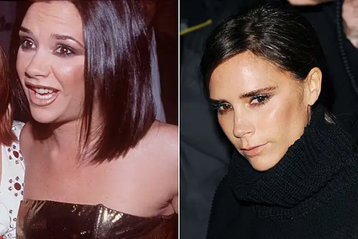 Victoria Beckham: Πόσο την άλλαξαν οι πλαστικές επεμβάσεις όλα αυτά τα χρόνια; Victoria Beckham: Πόσο την άλλαξαν οι πλαστικές επεμβάσεις όλα αυτά τα χρόνια;