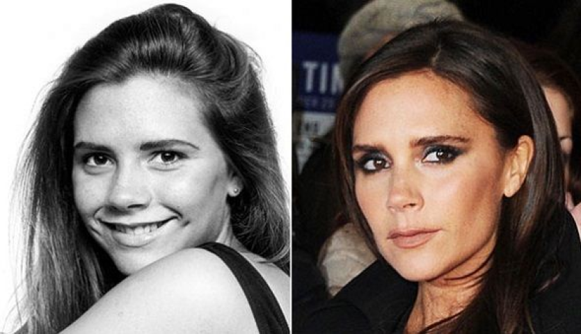 Victoria Beckham: Πόσο την άλλαξαν οι πλαστικές επεμβάσεις όλα αυτά τα χρόνια; Victoria Beckham: Πόσο την άλλαξαν οι πλαστικές επεμβάσεις όλα αυτά τα χρόνια;