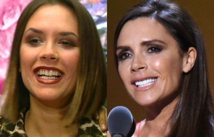 Victoria Beckham: Πόσο την άλλαξαν οι πλαστικές επεμβάσεις όλα αυτά τα χρόνια; Victoria Beckham: Πόσο την άλλαξαν οι πλαστικές επεμβάσεις όλα αυτά τα χρόνια;