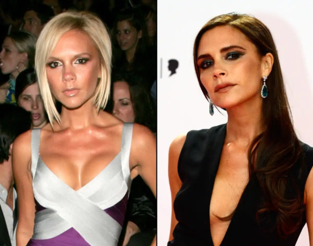 Victoria Beckham: Πόσο την άλλαξαν οι πλαστικές επεμβάσεις όλα αυτά τα χρόνια; Victoria Beckham: Πόσο την άλλαξαν οι πλαστικές επεμβάσεις όλα αυτά τα χρόνια;